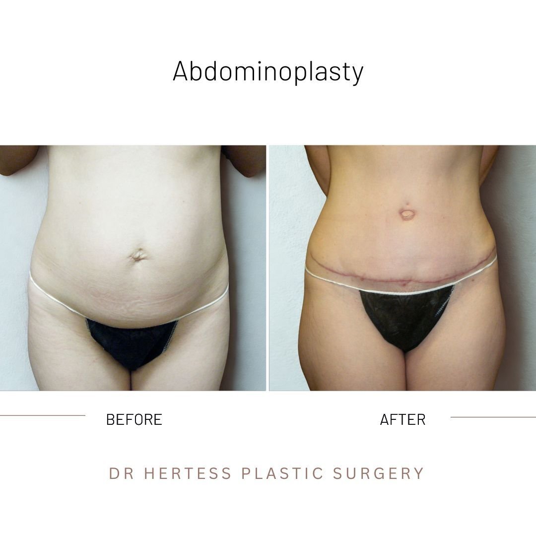 1-Nov-11-2025-02-59-46-4606-AM