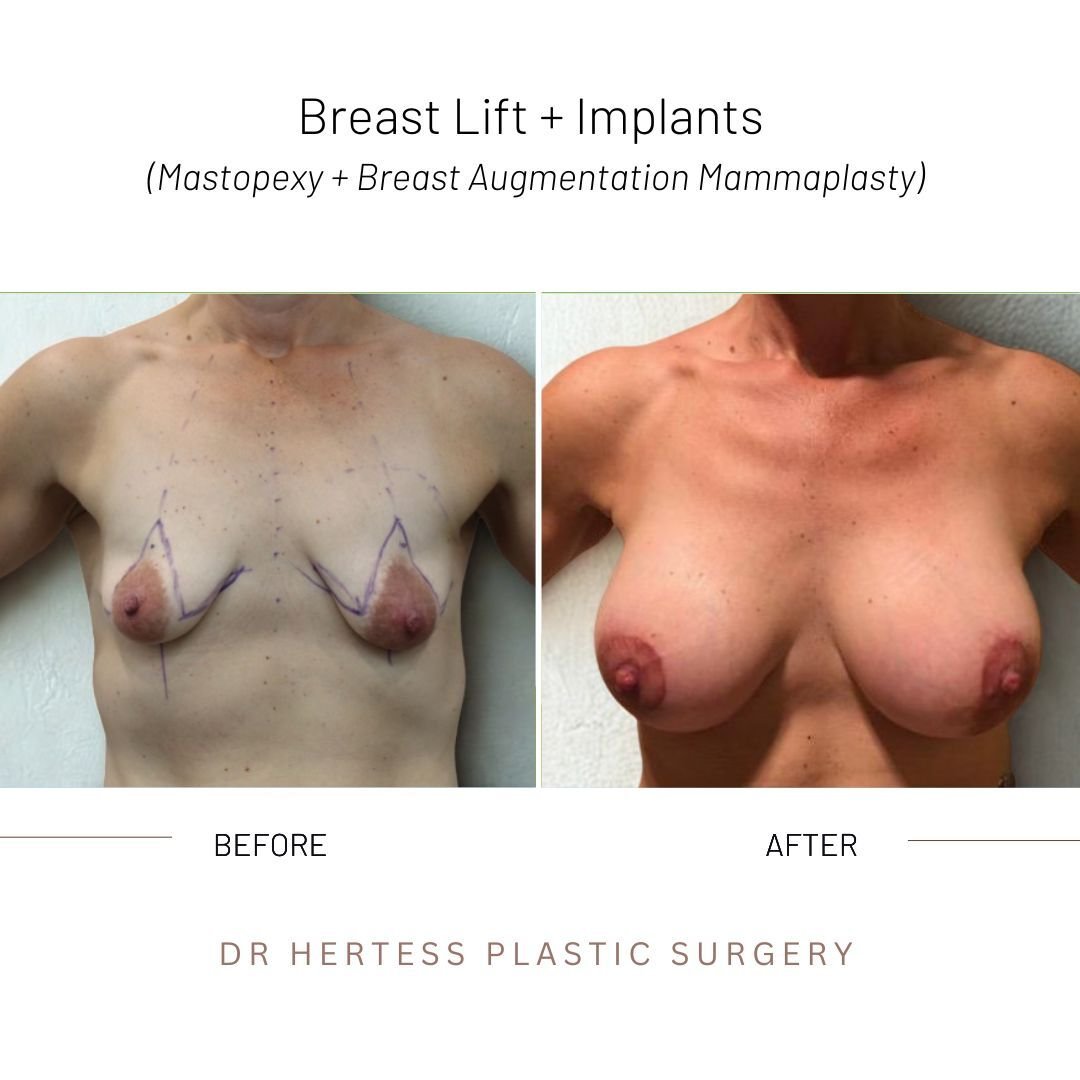 11-Nov-10-2025-12-33-06-4724-AM