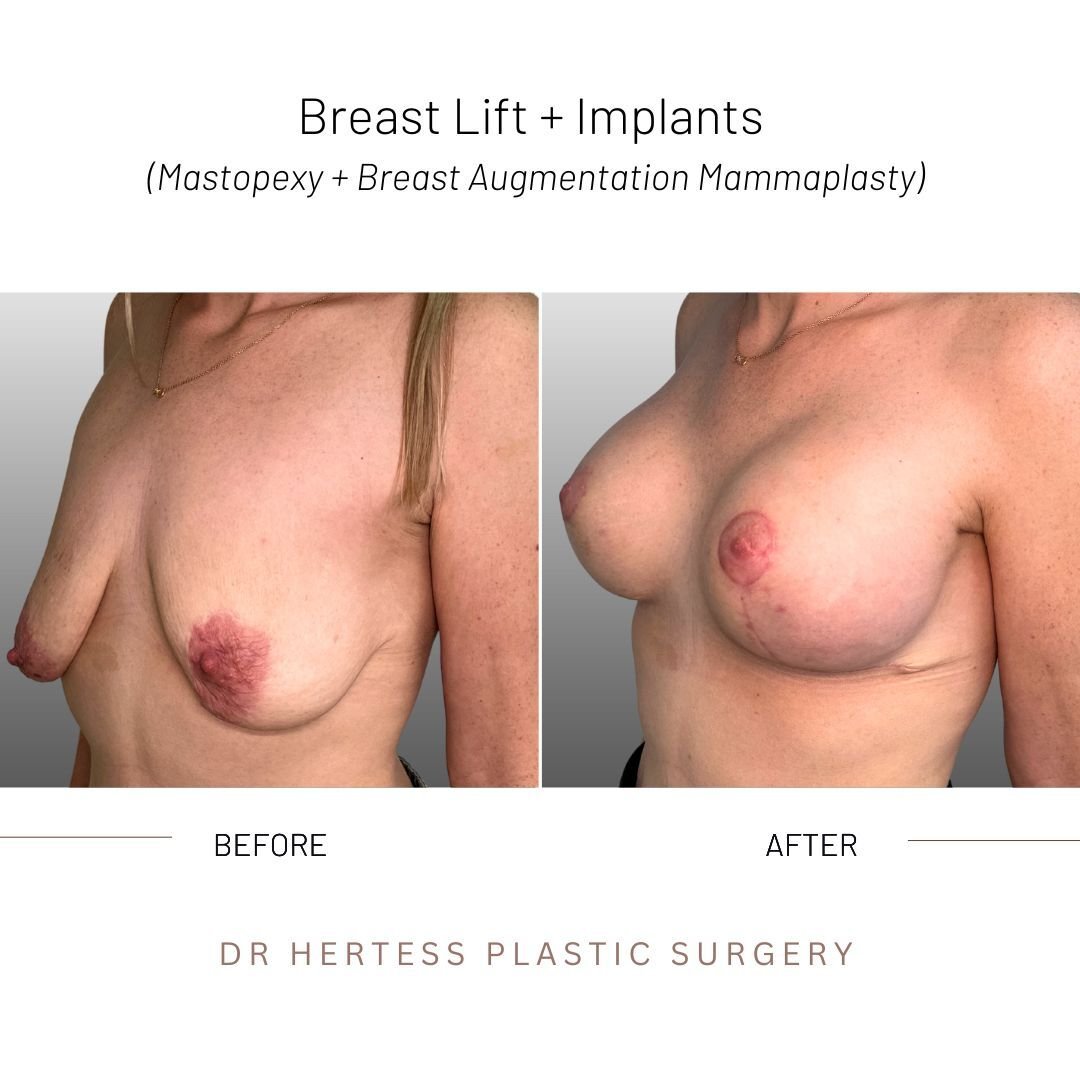 2-Nov-10-2025-12-33-06-6043-AM