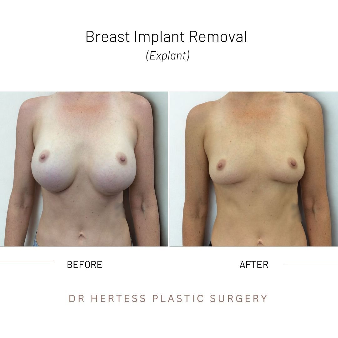 2-Nov-11-2025-02-27-42-6924-AM