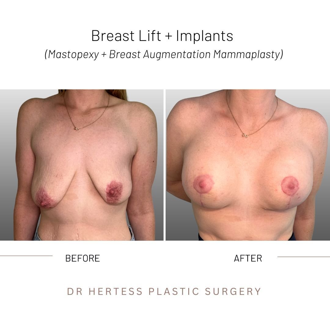 3-Nov-10-2025-12-33-06-6033-AM