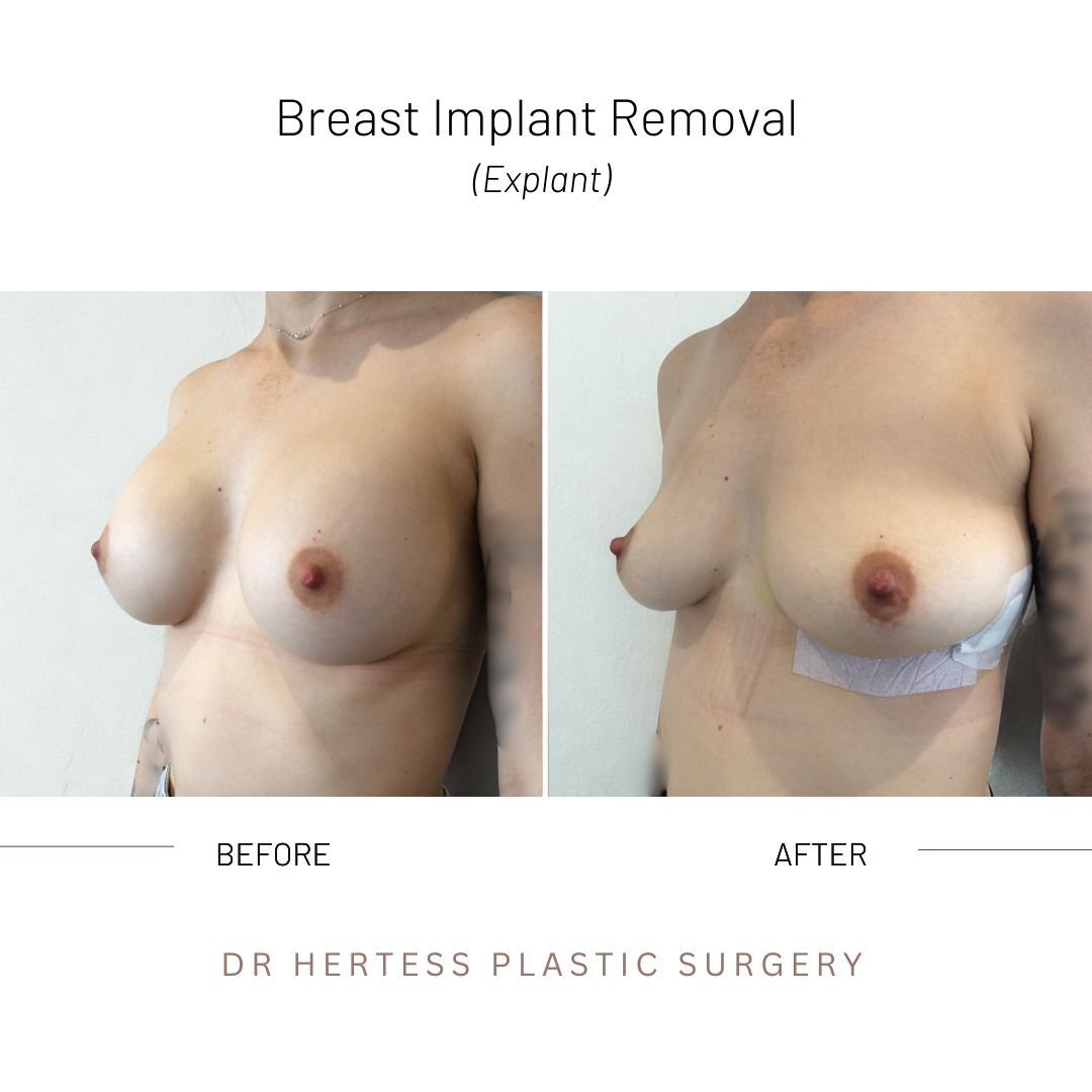 3-Nov-11-2025-02-27-02-8149-AM