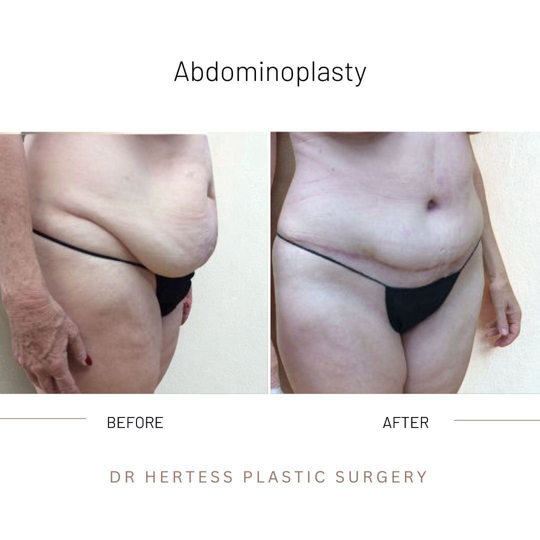 3-Nov-11-2025-02-59-46-5046-AM