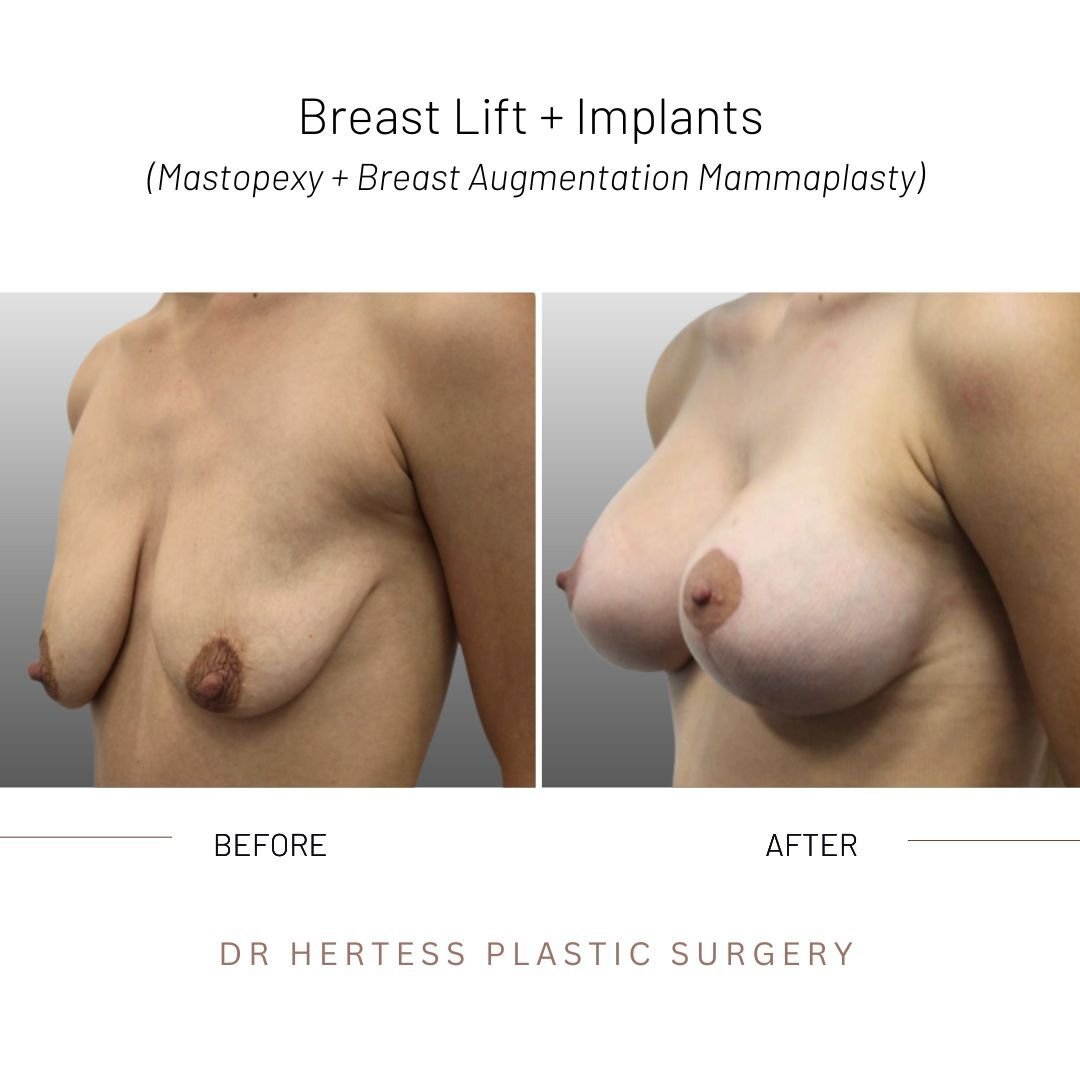 4-Nov-10-2025-12-33-06-5774-AM