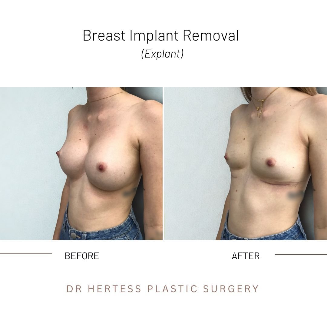 4-Nov-11-2025-02-26-48-2245-AM