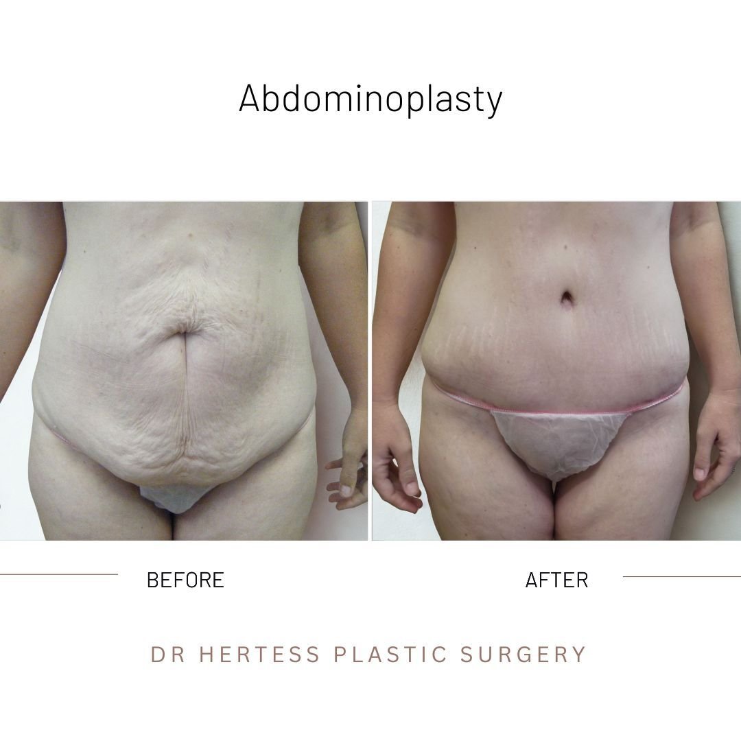 4-Nov-11-2025-02-59-46-4610-AM