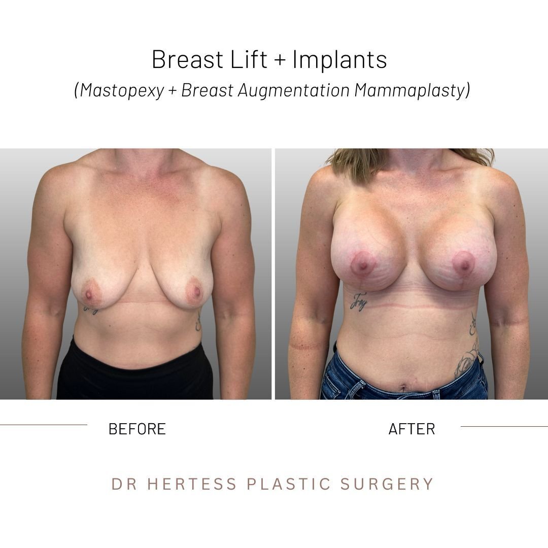 5-Nov-10-2025-12-33-06-6060-AM