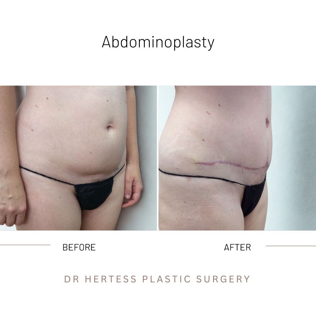 5-Nov-11-2025-02-59-46-5128-AM