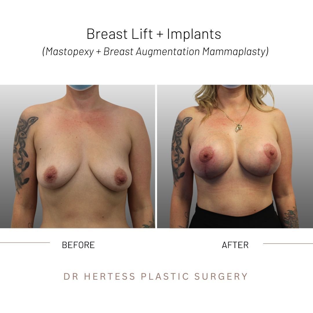 6-Nov-10-2025-12-33-06-5742-AM