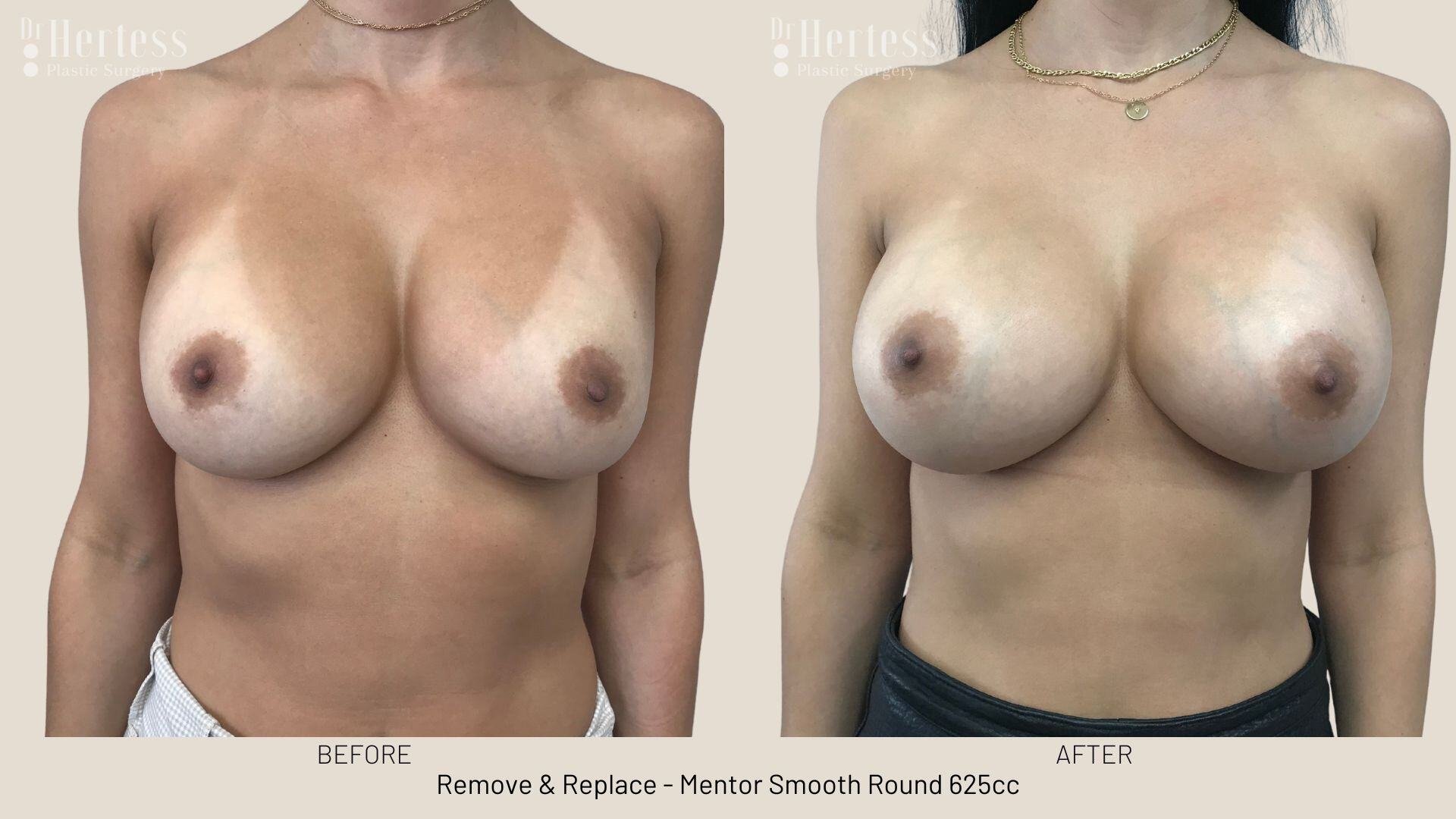 remove replace photos