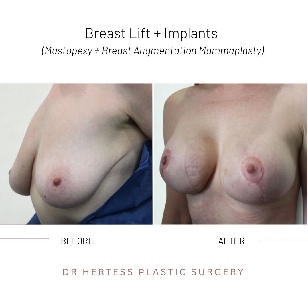 7-Nov-10-2025-12-33-06-4901-AM