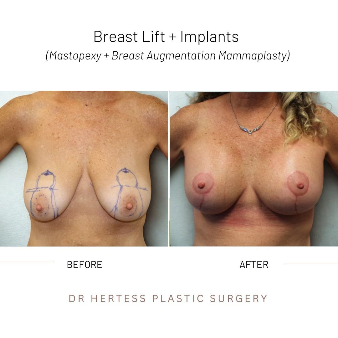 9-Nov-10-2025-12-33-06-4874-AM