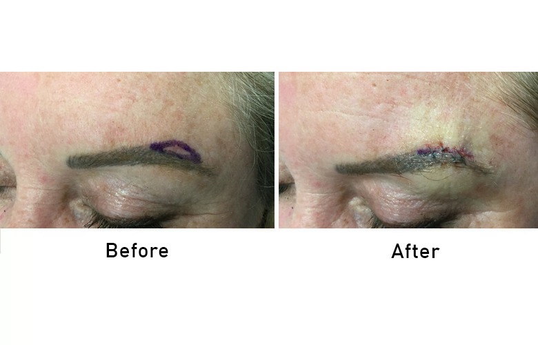 cairns_before-after_gallery-11-1