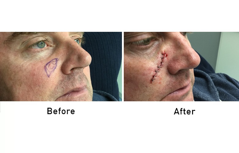 cairns_before-after_gallery-12-1