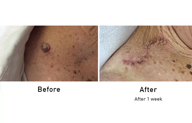 cairns_before-after_gallery-19-1