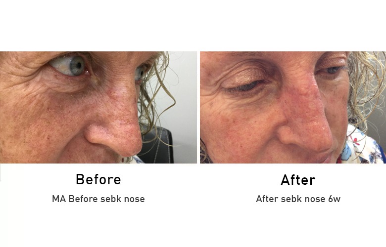 cairns_before-after_gallery-20-1