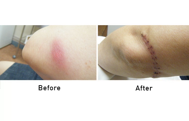 cairns_before-after_gallery-4-1