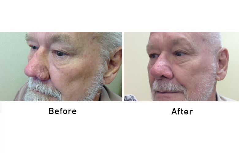 cairns_before-after_gallery-5-1