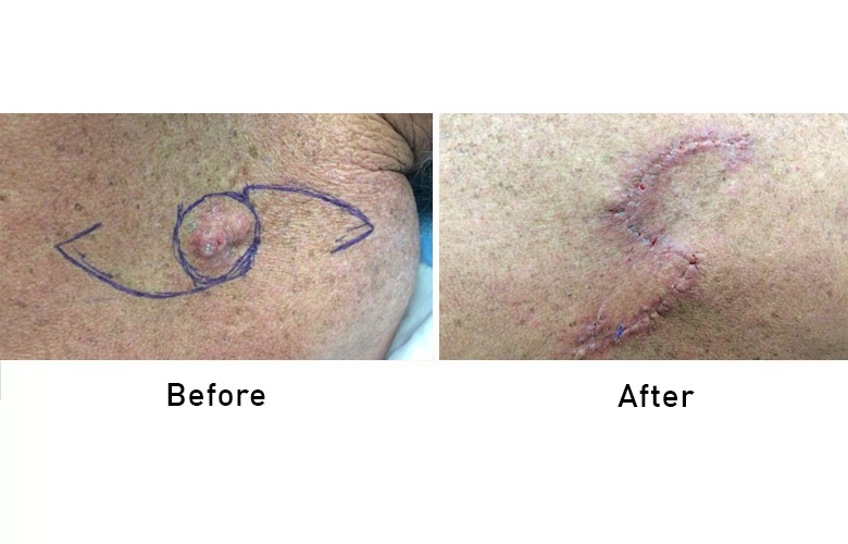 cairns_before-after_gallery-7-1